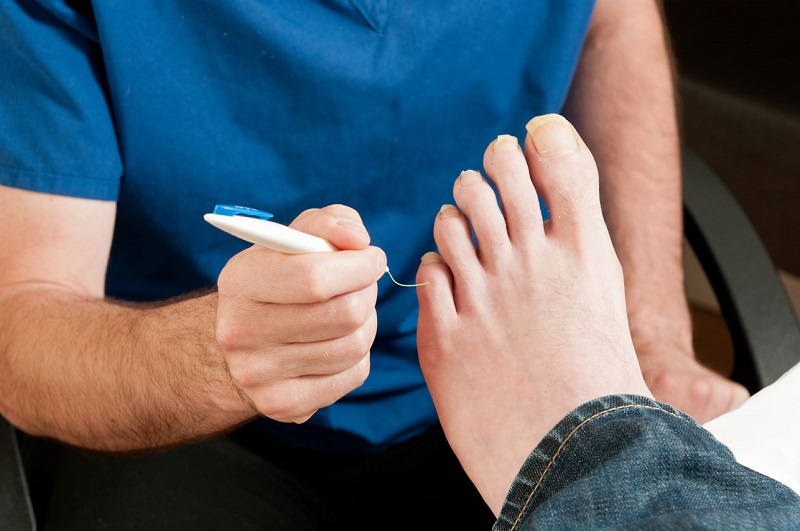 diabetic foot assessment sydney